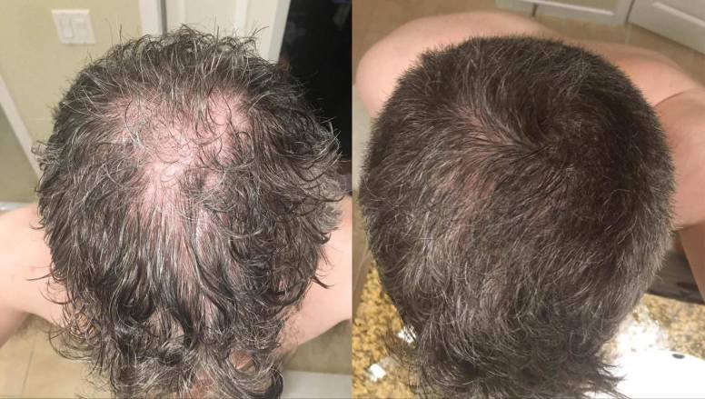 Before and After - Robert
