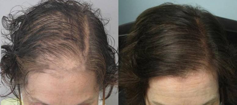 Before and After - David